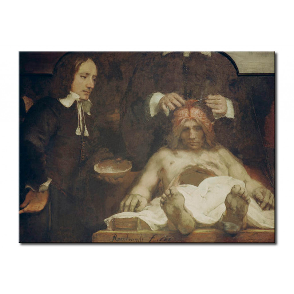 Schilderij  Rembrandt: The Anatomy Lesson Of Dr. Johan Deijman