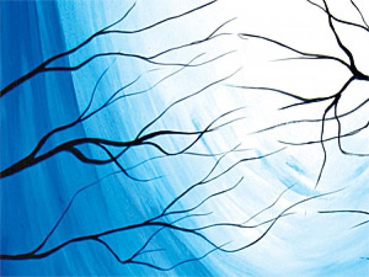 Quadro em tela Árvores misteriosas 49836 additionalImage 2